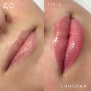 Фотография Grushka 2