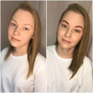 Фотография Still Epil 2