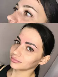 Фотография Still Epil 4