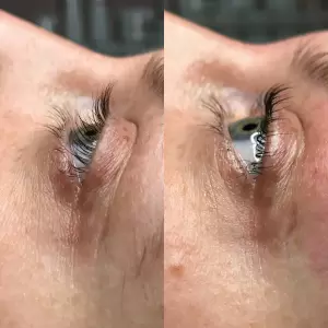 Фотография Still Epil 5